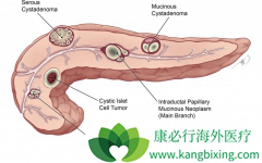 ������һ�ֳ����ĵ������ٰ�֢״