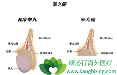 �G���ʵؼ�ӲҲ�п�����غ�谩֢״