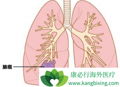 �ΰ������Ѿ�����ȫ���Էΰ���������