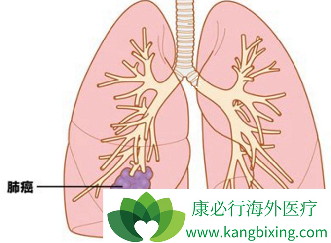 �ΰ�������