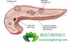 ���ٰ�֢״���ֺ���Ҫ����ȥҽԺ���м��