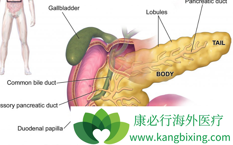 胰腺癌症状 胰腺癌症状