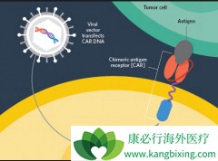 ŵ��CAR-Tϸ���Ʒ�KYMRIAH����������Ӧ֢