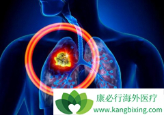 �չ˷ΰ�����Ҳ�ð�����Ϊ���ڷΰ��ᴫȾ��