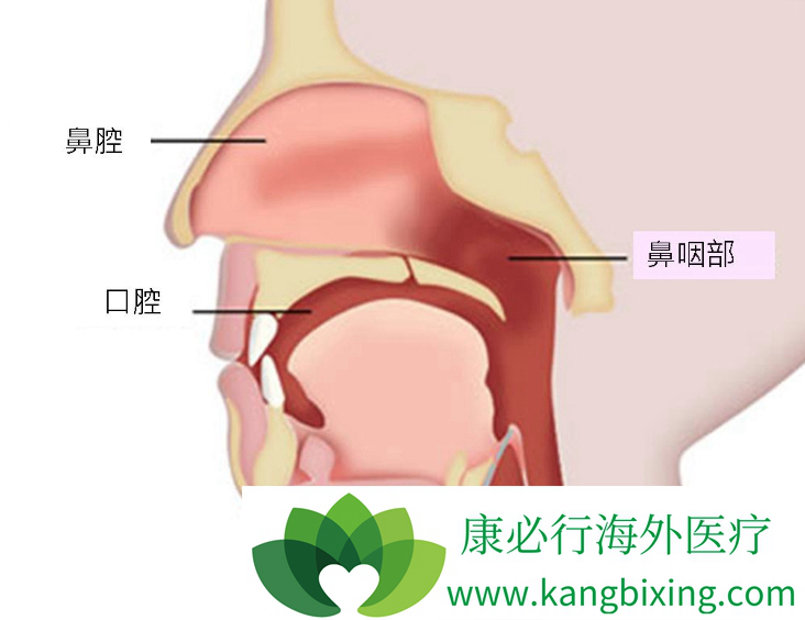 鼻咽癌症状 鼻咽癌症状