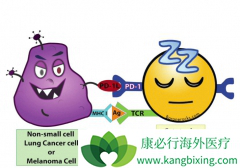 ������PD-1���Ƽ���θ��������ȡ�����ش��չ