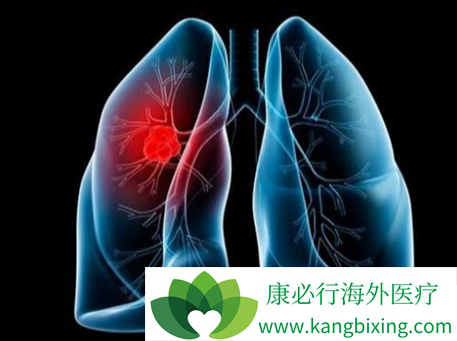 肺癌术后饮食 肺癌术后饮食