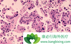 ��Сϸ���ΰ��ٰ�����������������ս