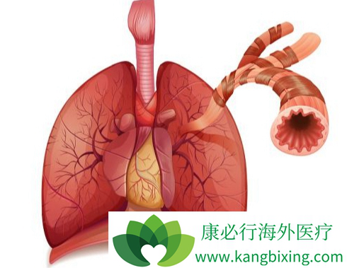 肺癌手术后 肺癌手术后