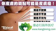 ���ԳƵ������������Ƥ����֢״֮һ