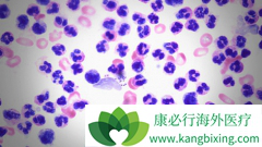 Сϸ���ΰ���ת�Ʒ������ϻ��ƿ����������Ч