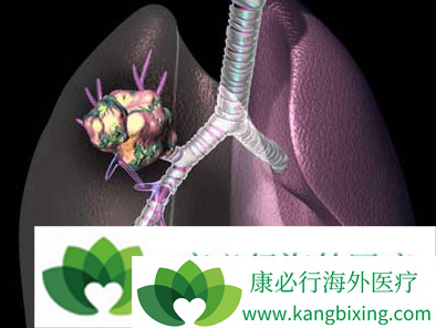 中药治疗肺癌 中药治疗肺癌