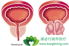 ���緢��ǰ���ٰ�֢������ֶ��Ƕ��ڽ��м��