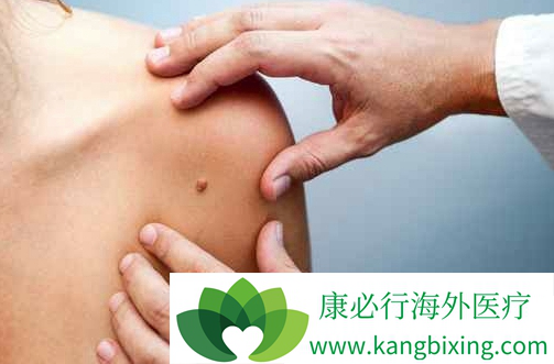 皮肤癌症状 皮肤癌症状