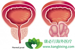 ǰ���ٰ�֢��ָ������ǰ���ٵ���Ƥ�Զ�������