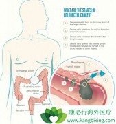 ��Ѫ�Ƿǳ����������ڴ󳦰�֢״֮һ