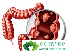 ���ڴ󳦰�֢״���̴��Ƚ���