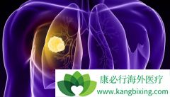 ��Сϸ���ΰ��������ƵĶ��߲���