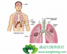 ���߷ΰ��������κ��������Ʒ�����ʲô