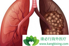 �ѳ��ֶദת��������ڷΰ�������