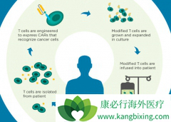 CAR-Tϸ���Ʒ���һ�����͵Ķ���ѪҺ�������ֶ�