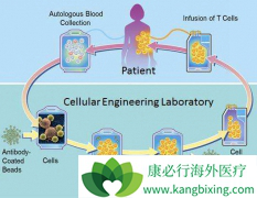 ����ѪҺ��������ʲôʱ�������CAR-T�Ʒ���