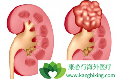 ����Ӧ�������ڸ�Ѫѹ��Ѫ������֢״