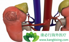 ������������ֵ��Ͳ�֢����������֢״