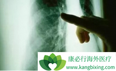 �ΰ�����֢״�Լ����׻����Ĵ���Ԥ��֢״