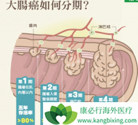 ��ʮ������ı䵱���Ǵ󳦰�֢״