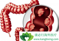 �������ر�Ѫ���Ǵ󳦰�֢״�ı�����