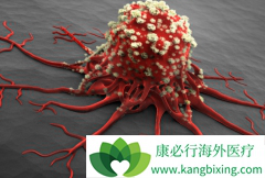 �����ŷ�ɥ���İ�֢������Ϊ��֢�ᴫȾ��