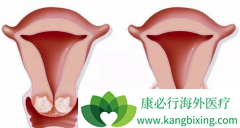 ���ư�֢������֢״����ݲ����ַ���Χ���̷ּ���֢״