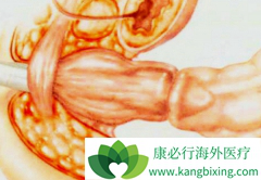 �ٴ�������ֱ����֢״���־����ű�ϰ�߸ı�