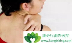 �����Ծ��ҵ�Ƥ��ʹ�������ǰ�֢ǰ��