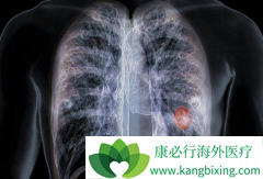 ��ʹ���˸о������岻�ʵ������ַΰ�����֢״