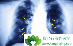 �ΰ��������ƹ�����Ӧע�⻼��Ӫ��Ԫ�ص���ȡ