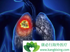 �ν�˲��˲������ص��ΰ����ڴ�Ⱦ��