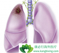 ר����ϸΪ�㽲��ΰ����ڻᴫȾ��