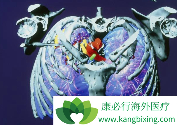 晚期肺癌 晚期肺癌