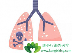 Ԥ���ΰ�����Ҫ��ע���߲�����������