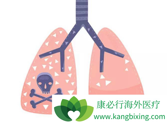 Ԥ���ΰ�����