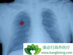 ���ڷΰ����ƺ���10��������Ͳ�����