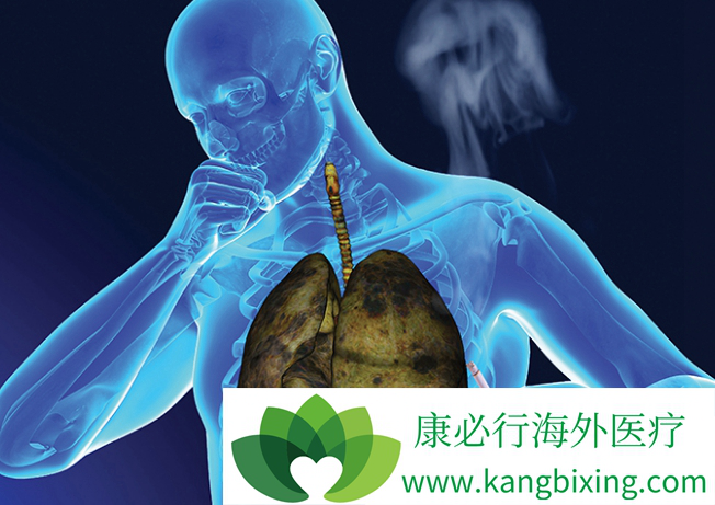 肺癌的治疗方法 肺癌的治疗方法