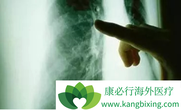 晚期肺癌治疗 晚期肺癌治疗