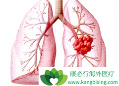 ���ֻ��������ڷΰ�������������ѡ�����