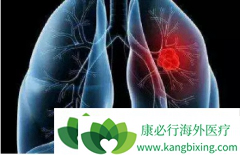 �ΰ���������������ĵ�����֮�ΰ����ڴ�Ⱦ��