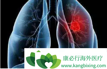 �ΰ����ڴ�Ⱦ��