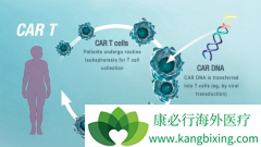 CAR-Tϸ�����Ʒ���KYMRIAH����ʵ��Ч��ô����