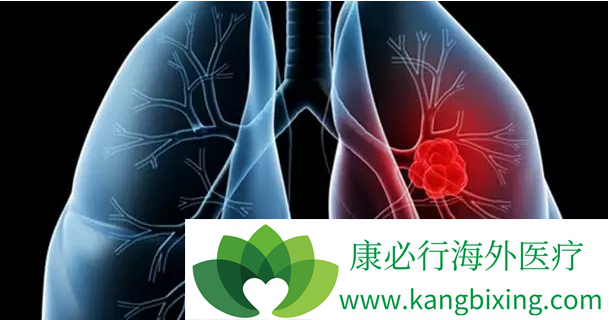 肺癌晚期传染吗 肺癌晚期传染吗